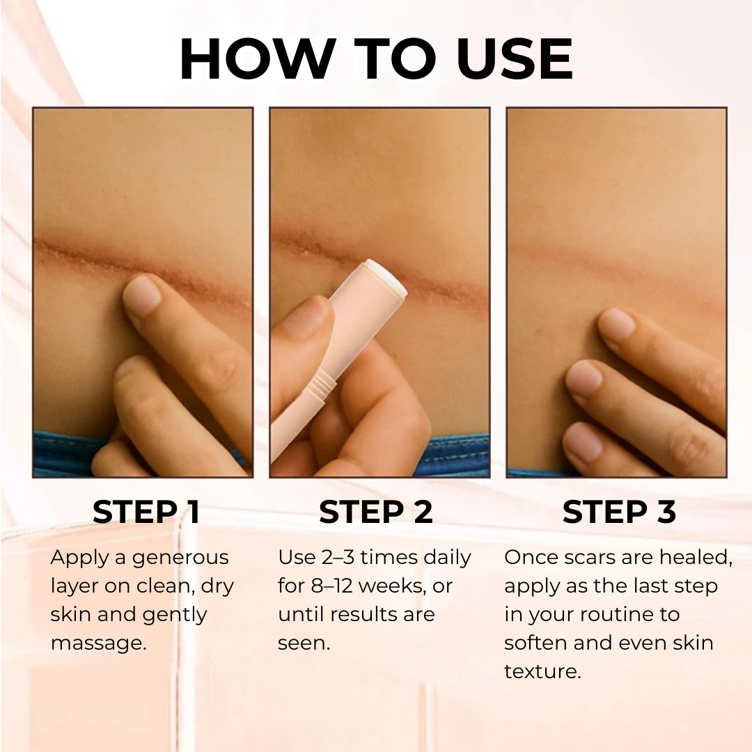 OVELLE Silicone Scar Stick